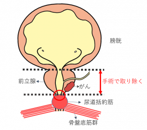 慢性前立腺炎でお悩みの患者さんへ | みうら泌尿器科クリニック