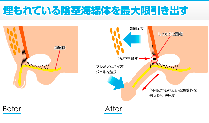 ペニスの大きさ平均は13cm！女性の理想サイズはさらにデカい！？｜薬の通販オンライン