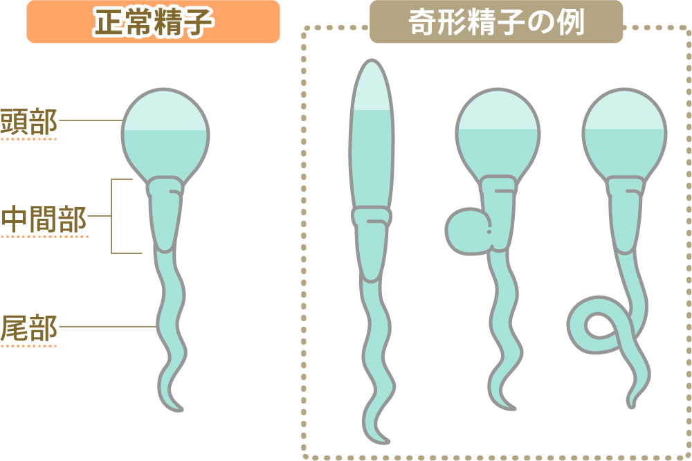 永遠に続く射精感…!! 禁断のオナニー・「ウィダニー」とは？｜BLニュース ちるちる