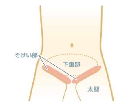 初めての方へ｜新宿・渋谷・宇都宮でメンズ脱毛ならロミオワックス|男性専門サロン|ブラジリアンワックス/光脱毛/ダブル脱毛 - メンズ脱毛はロミオワックス 【ブラジリアンワックス・VIO・ヒゲ脱毛】