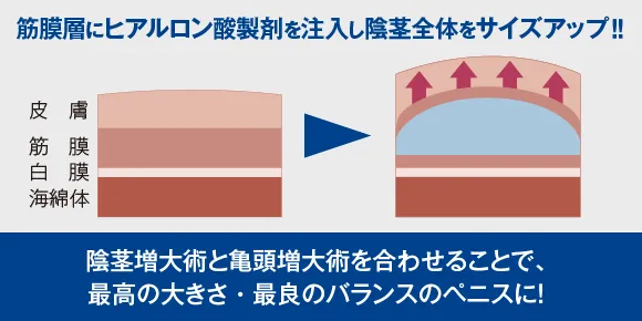 ペニスの大きさの正しい測り方について解説！ちん長を測って自分のちんこのサイズを確認しよう | Men's