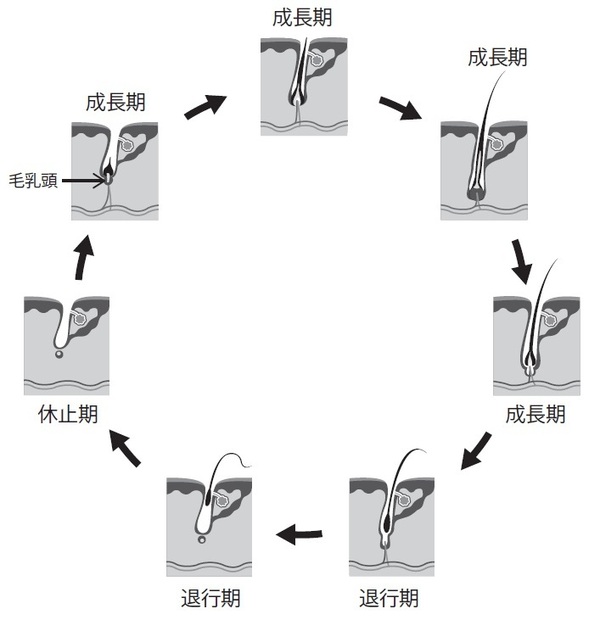 毛抜きでも毛根は死ぬ？やり方と脱毛との関係・痛くない方法は？ | 内科総合クリニック人形町