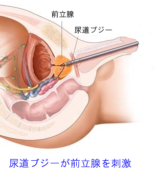 尿道からの前立腺プレイ | 電マ好き