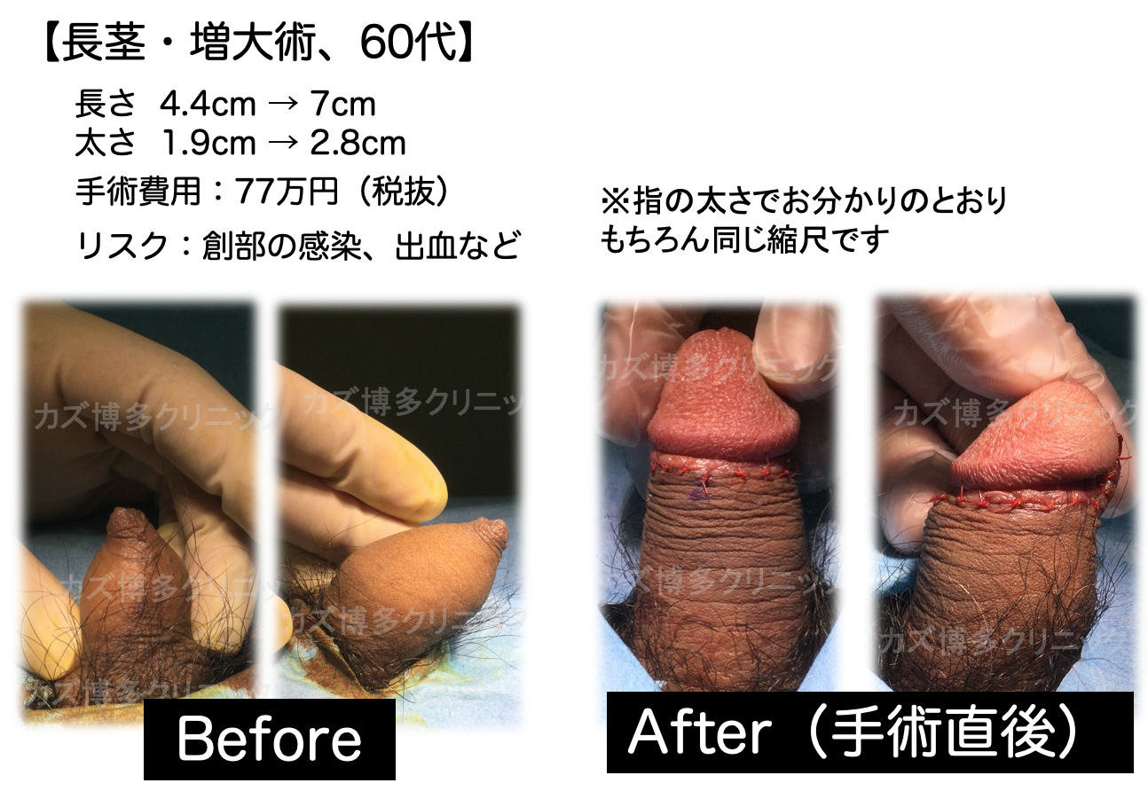 男性器の大きさについて｜大東製薬工業株式会社