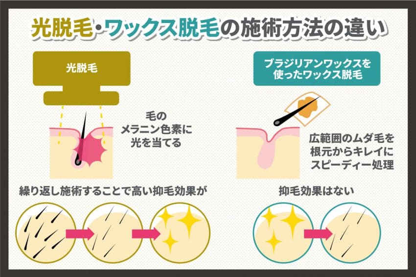 ○体毛の処理にブラジリアンワックス・ワックス脱毛おすすめ〆【東京新宿メンズサロン】 ｜ 東京新宿駅5分